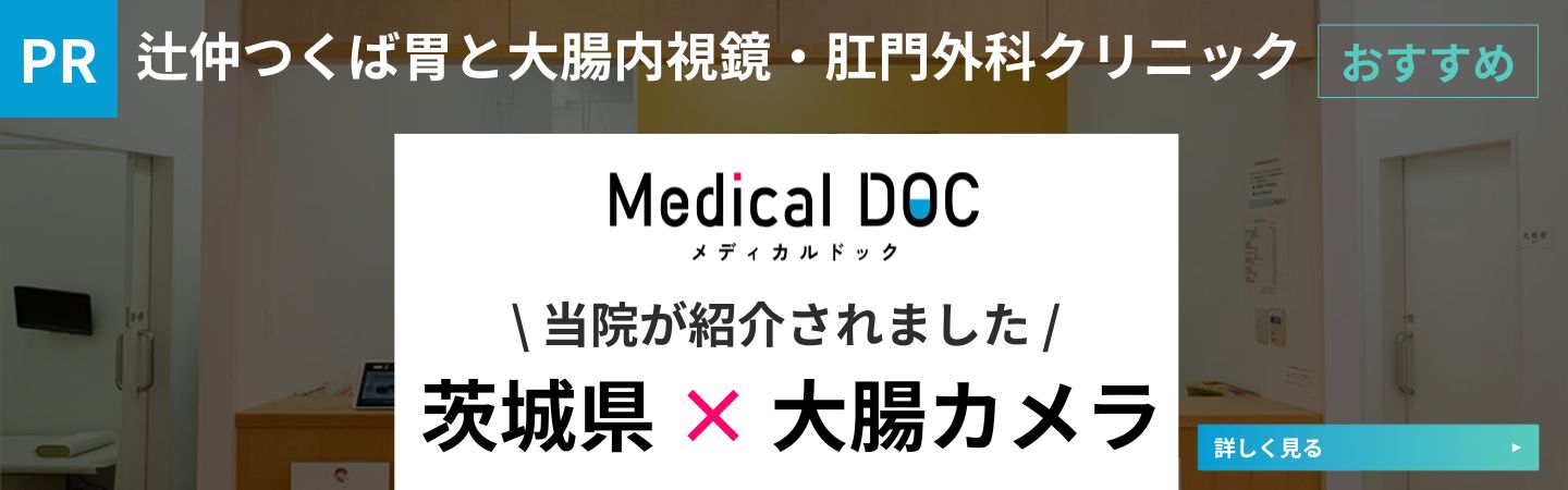 茨城県大腸内視鏡検査おすすめに選出