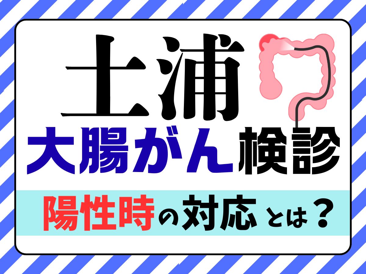 土浦市の大腸がん検診、大腸内視鏡検査を推奨するイメージ画像
