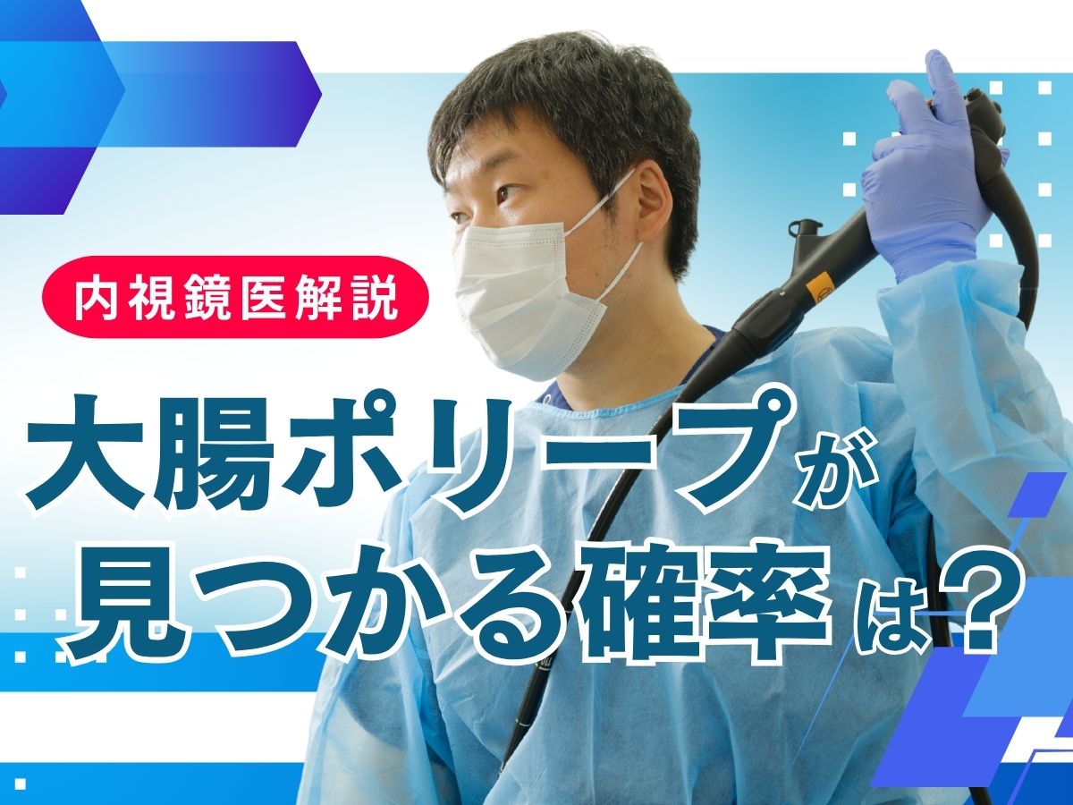 大腸ポリープが見つかる確率について解説