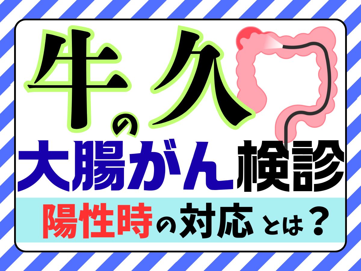 牛久市の大腸がん検診、大腸内視鏡検査を推奨するイメージ画像